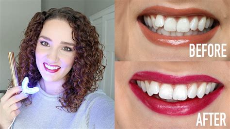The Science Behind Snow Magic Whitening Strips: How They Work